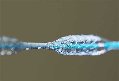  Nitinol: Un Campeón de la Flexibilidad y Resistencia para Aplicaciones Biomédicas Innovadoras